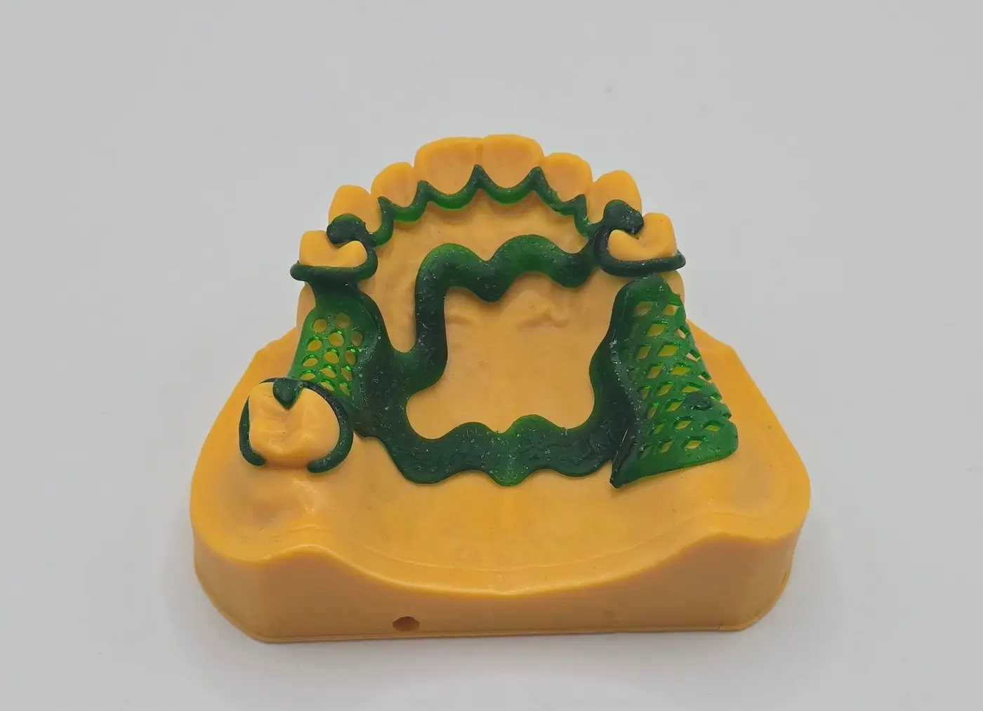 Impression 3D Résine Dentaire